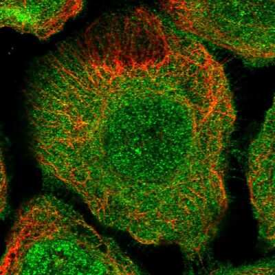 Immunocytochemistry/Immunofluorescence: TBC1D9B Antibody [NBP1-81490] - Immunofluorescent staining of human cell line A-431 shows localization to nucleus & plasma membrane.