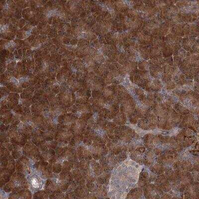 Immunohistochemistry-Paraffin: TBC1D9B Antibody [NBP1-81490] - Staining of human pancreas shows strong cytoplasmic positivity in exocrine glandular cells.