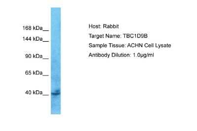 Western Blot: TBC1D9B Antibody [NBP2-83623] - Host: Rabbit. Target Name: TBC1D9B. Sample Tissue: Human ACHN Whole Cell. Antibody Dilution: 1ug/ml