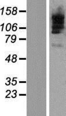 Western Blot TBC1D9B Overexpression Lysate
