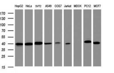Western Blot: TBCC Antibody (OTI1B2) - Azide and BSA Free [NBP2-74465] - Analysis of extracts (35ug) from 9 different cell lines by using g TBCC monoclonal antibody (HepG2: human; HeLa: human; SVT2: mouse; A549: human; COS7: monkey; Jurkat: human; MDCK: canine; PC12: rat; MCF7: human).