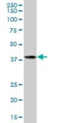 Western Blot: TBCC Antibody [H00006903-B01P] - Analysis of TBCC expression in human spleen.