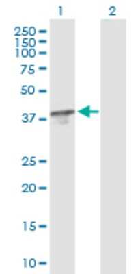 Western Blot: TBCC Antibody [H00006903-B01P] - Analysis of TBCC expression in transfected 293T cell line by TBCC polyclonal antibody.  Lane 1: TBCC transfected lysate(38.06 KDa). Lane 2: Non-transfected lysate.