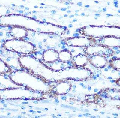 Immunohistochemistry-Paraffin: TBCCD1 Antibody [NBP2-94513] - Mouse kidney using TBCCD1 Rabbit pAb at dilution of 1:100 (40x lens).