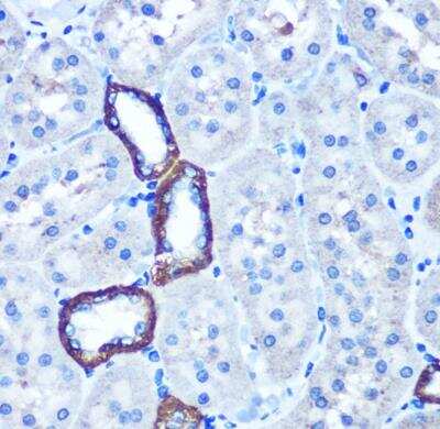 Immunohistochemistry-Paraffin: TBCCD1 Antibody [NBP2-94513] - Rat kidney using TBCCD1 Rabbit pAb at dilution of 1:100 (40x lens).