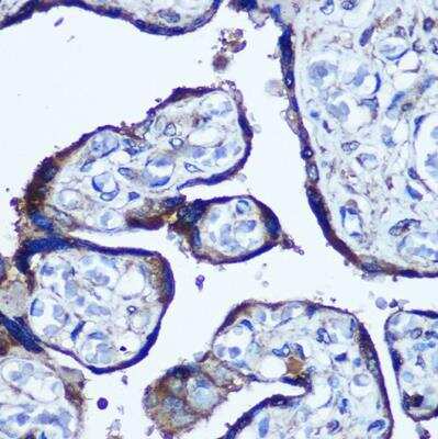 Immunohistochemistry-Paraffin: TBCCD1 Antibody [NBP2-94513] - Human placenta using TBCCD1 Rabbit pAb at dilution of 1:100 (40x lens