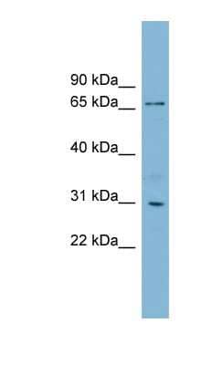 Western Blot: TBCCD1 Antibody [NBP1-55394] - HeLa cell lysate, concentration 0.2 - 1 ug/mL.
