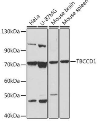 Western Blot: TBCCD1 Antibody [NBP2-94513] - Analysis of extracts of various cell lines, using TBCCD1 Rabbit pAb at 1:1000 dilution. Secondary antibody: HRP Goat Anti-Rabbit IgG (H+L)  at 1:10000 dilution.Lysates/proteins: 25ug per lane. Blocking buffer: 3% nonfat dry milk in TBST.Detection: ECL Basic Kit. Exposure time: 60s.