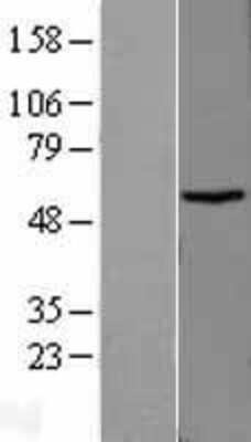 Western Blot: TBCCD1 Overexpression Lysate (Adult Normal) [NBP2-09543] Left-Empty vector transfected control cell lysate (HEK293 cell lysate); Right -Over-expression Lysate for TBCCD1.