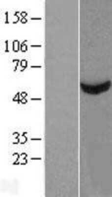 Western Blot: TBCE Overexpression Lysate (Adult Normal) [NBP2-08470] Left-Empty vector transfected control cell lysate (HEK293 cell lysate); Right -Over-expression Lysate for TBCE.