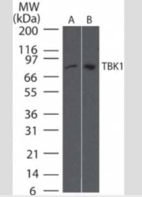 Western Blot: TBK1 Antibody (108A429) - Azide and BSA Free [NBP2-33243] - Human Daudi (A) and mouse RAW (B) cell lysate probed with TBK1 antibody at 2 ug/ml.