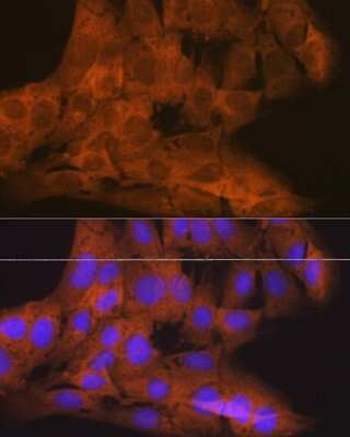 Immunocytochemistry/Immunofluorescence: TBK1 Antibody (4G6C7) [NBP3-16189] - Immunofluorescence analysis of C6 cells using TBK1 Rabbit mAb (NBP3-16189) at dilution of 1:100 (40x lens). Blue: DAPI for nuclear staining.