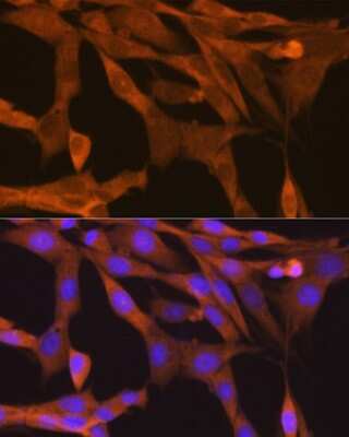 Immunocytochemistry/Immunofluorescence: TBK1 Antibody (4G6C7) [NBP3-16189] - Immunofluorescence analysis of NIH-3T3 cells using TBK1 Rabbit mAb (NBP3-16189) at dilution of 1:100 (40x lens). Blue: DAPI for nuclear staining.