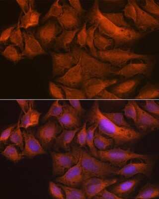 Immunocytochemistry/Immunofluorescence: TBK1 Antibody (4G6C7) [NBP3-16189] - Immunofluorescence analysis of U-2 OS cells using TBK1 Rabbit mAb (NBP3-16189) at dilution of 1:100 (40x lens). Blue: DAPI for nuclear staining.