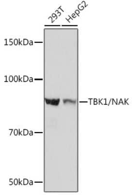 Western Blot: TBK1 Antibody (4G6C7) [NBP3-16189] - Western blot analysis of extracts of various cell lines, using TBK1 Rabbit mAb (NBP3-16189) at 1:1000 dilution. Secondary antibody: HRP Goat Anti-Rabbit IgG (H+L) at 1:10000 dilution. Lysates/proteins: 25ug per lane. Blocking buffer: 3% nonfat dry milk in TBST. Detection: ECL Basic Kit. Exposure time: 3s.