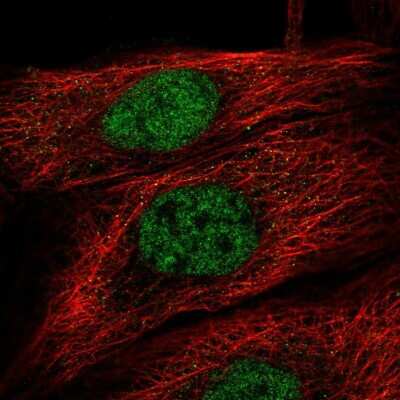 Immunocytochemistry/Immunofluorescence: TBK1 Antibody [NBP2-13416] - Staining of human cell line A-431 shows localization to nucleoplasm.