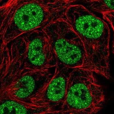 Immunocytochemistry/Immunofluorescence: TBK1 Antibody [NBP2-55777] - Staining of human cell line RT4 shows localization to nucleoplasm.