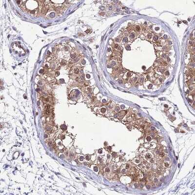 Immunohistochemistry-Paraffin: TBK1 Antibody [NBP2-13416] - Staining of human testis shows moderate cytoplasmic, membranous and nuclear positivity in cells in seminiferus ducts.