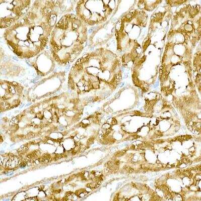 Immunohistochemistry-Paraffin: TBK1 Antibody [NBP2-93921] - Rat kidney using TBK1/NAK Rabbit pAb at dilution of 1:200 (40x lens).Perform high pressure antigen retrieval with 10 mM citrate buffer pH 6.0 before commencing with IHC staining protocol.