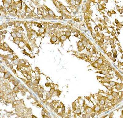 Immunohistochemistry-Paraffin: TBK1 Antibody [NBP2-93921] - Rat testis using TBK1/NAK Rabbit pAb at dilution of 1:200 (40x lens).Perform high pressure antigen retrieval with 10 mM citrate buffer pH 6.0 before commencing with IHC staining protocol.