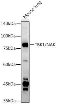 Western Blot: TBK1 Antibody [NBP2-93921] - Analysis of extracts of Mouse lung, using TBK1/NAK antibody at 1:1000 dilution.Secondary antibody: HRP Goat Anti-Rabbit IgG (H+L) at 1:10000 dilution.Lysates/proteins: 25ug per lane. Blocking buffer: 3% nonfat dry milk in TBST.Detection: ECL Basic Kit. Exposure time: 90s.