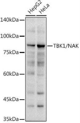 Western Blot: TBK1 Antibody [NBP2-93921] - Analysis of extracts of various cell lines, using TBK1/NAK antibody at 1:1000 dilution. Secondary antibody: HRP Goat Anti-Rabbit IgG (H+L) at 1:10000 dilution.Lysates/proteins: 25ug per lane. Blocking buffer: 3% nonfat dry milk in TBST.Detection: ECL Basic Kit. Exposure time: 30s.