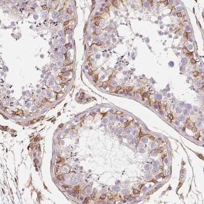 Immunohistochemistry-Paraffin: TBKBP1 Antibody [NBP2-38057] - Staining of human testis shows strong cytoplasmic positivity in subset of cells in seminiferus ducts of testis.
