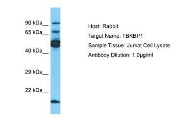 Western Blot: TBKBP1 Antibody [NBP2-88420] - Host: Rabbit. Target Name: TBKBP1. Sample Type: Jurkat Whole Cell lysates. Antibody Dilution: 1.0ug/ml