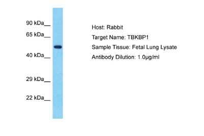 Western Blot: TBKBP1 Antibody [NBP2-88421] - Host: Rabbit. Target Name: TBKBP1. Sample Type: Fetal Lung lysates. Antibody Dilution: 1.0ug/ml