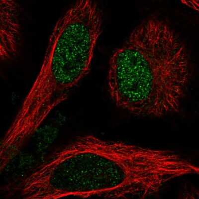 Immunocytochemistry/Immunofluorescence: TBL1 Antibody [NBP2-56033] - Staining of human cell line HeLa shows localization to nucleus.