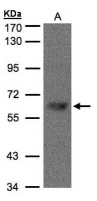 Western Blot: TBL1 Antibody [NBP1-31058] - Sample(30 ug of whole cell lysate)A:HeLa S3 7. 5% SDS PAGE, antibody diluted at 1:1000.