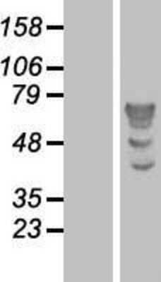 Western Blot: TBL1 Overexpression Lysate (Adult Normal) [NBP2-10452] Left-Empty vector transfected control cell lysate (HEK293 cell lysate); Right -Over-expression Lysate for TBL1.