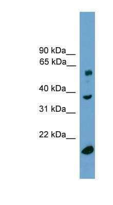 Western Blot: TBL1Y Antibody [NBP1-79459] - TBL1Y Antibody Human Lung lysate, concentration 0.2-1 ug/ml.