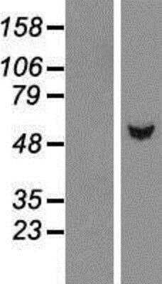 Western Blot: TBL1Y Overexpression Lysate [NBP2-05691] - Left-Empty vector transfected control cell lysate (HEK293 cell lysate); Right -Over-expression Lysate for TBL1.
