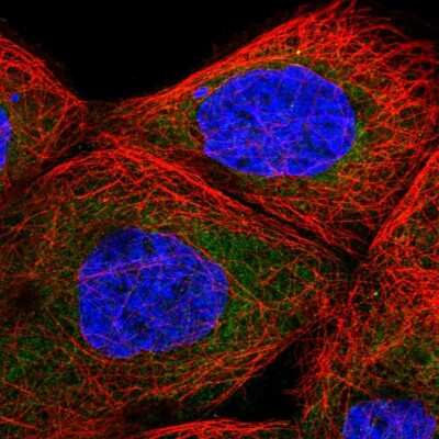 Immunocytochemistry/Immunofluorescence: TBL2 Antibody [NBP2-55580] - Staining of human cell line A-431 shows localization to cytosol.