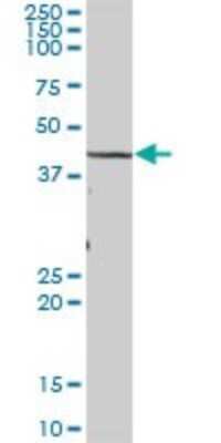 Western Blot TBL2 Antibody - Azide and BSA Free
