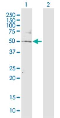 Western Blot: TBL2 Antibody [H00026608-D01P] - Analysis of TBL2 expression in transfected 293T cell line by TBL2 polyclonal antibody.Lane 1: TBL2 transfected lysate(49.80 KDa).Lane 2: Non-transfected lysate.
