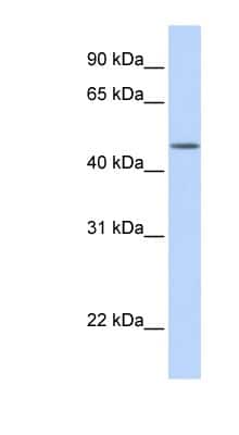 Western Blot: TBL2 Antibody [NBP1-62346] - Human Brain lysate, concentration 0.2-1 ug/ml.