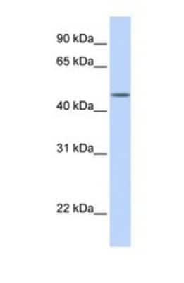 Western Blot: TBL2 Antibody [NBP1-69369] - This Anti-TBL2 antibody was used in Western Blot of Fetal Brain tissue lysate at a concentration of 1ug/ml.