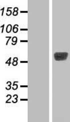 Western Blot TBL2 Overexpression Lysate