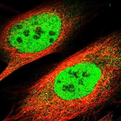 Immunocytochemistry/Immunofluorescence: TBLR1 Antibody [NBP1-89880] - Staining of human cell line U-2 OS shows localization to nucleoplasm. Antibody staining is shown in green.