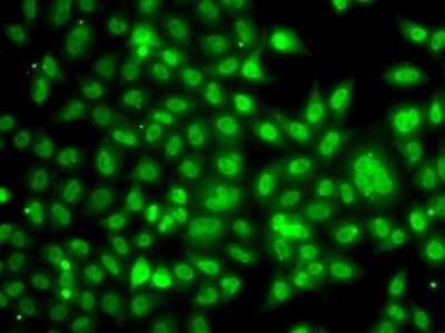 Immunocytochemistry/Immunofluorescence: TBLR1 Antibody [NBP2-94126] - Immunofluorescence analysis of A549 cells using TBLR1 antibody (NBP2-94126).