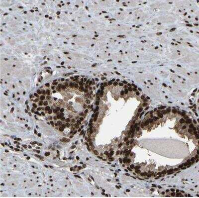 Immunohistochemistry-Paraffin: TBLR1 Antibody [NBP1-89880] - Staining of human prostate shows moderate to strong nuclear positivity in glandular cells.