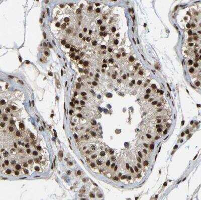 Immunohistochemistry-Paraffin: TBLR1 Antibody [NBP1-89880] -  Staining of human testis shows moderate to strong nuclear positivity in cells in seminiferous ducts.