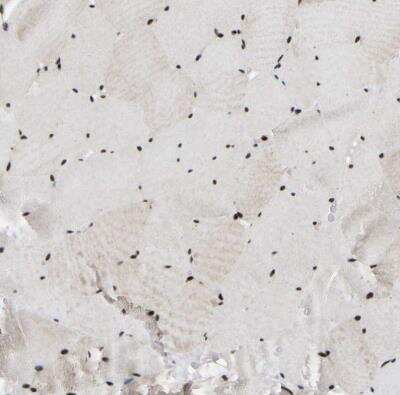 Immunohistochemistry-Paraffin: TBLR1 Antibody [NBP1-89880] - Staining of human skeletal muscle shows weak to moderate nuclear positivity in myocytes.