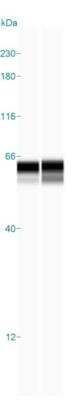 Simple Western: TBLR1 Antibody [NBP1-89880] - Simple Western lane view shows a specific band for TBLR1 in 0.2 mg/ml of RT-4 (left) and U-2 OS (right) lysate(s). This experiment was performed under reducing conditions using the 12-230 kDa separation system.