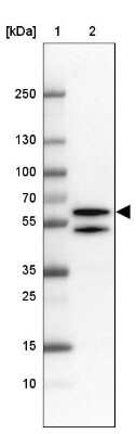 Western Blot TBLR1 Antibody - BSA Free