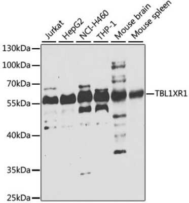 Western Blot: TBLR1 Antibody [NBP2-93697] - Analysis of extracts of various cell lines, using TBLR1 at 1:1000 dilution. Secondary antibody: HRP Goat Anti-Rabbit IgG (H+L) at 1:10000 dilution. Lysates/proteins: 25ug per lane. Blocking buffer: 3% nonfat dry milk in TBST. Detection: ECL Basic Kit . Exposure time: 10s.
