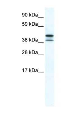 Western Blot: TBPL2 Antibody [NBP1-80268] - SP2/0 cell lysate, concentration 5.0ug/ml.