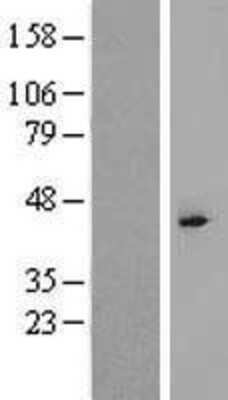 Western Blot: TBPL2 Overexpression Lysate (Adult Normal) [NBP2-04665] Left-Empty vector transfected control cell lysate (HEK293 cell lysate); Right -Over-expression Lysate for TBPL2.